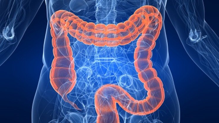 Νεότερες μελέτες δείχνουν ότι όλο και περισσότεροι άνθρωποι κάτω των 50 ετών εμφανίζουν τη νόσο / SHUTTERSTOCK