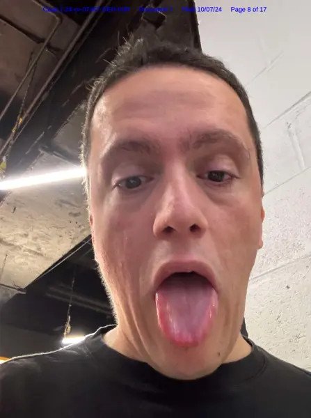 Ο Γερμανός τουρίστας φωτογράφισε τη γλώσσα του για να πείσει τον δικαστή ότι κάηκε και ότι έβγαλε φουσκάλες