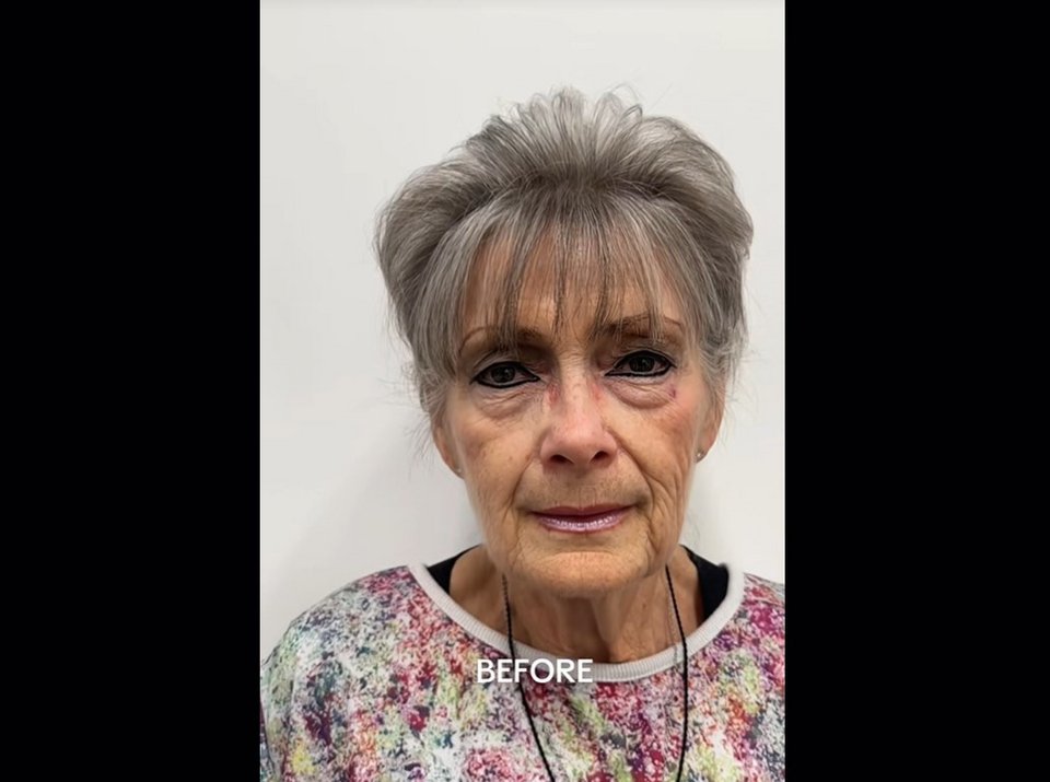 H 70χρονη με μακιγιάζ πριν το λίφτινγκ 