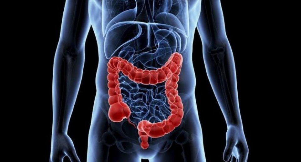 Οι επιστήμονες υποψιάζονται ότι η αύξηση αυτή μπορεί να σχετίζεται με τα υπερεπεξεργασμένα τρόφιμα, τα μικροπλαστικά και την ανεξήγητη αύξηση των φλεγμονωδών νόσων του εντέρου / SHUTTERSTOCK