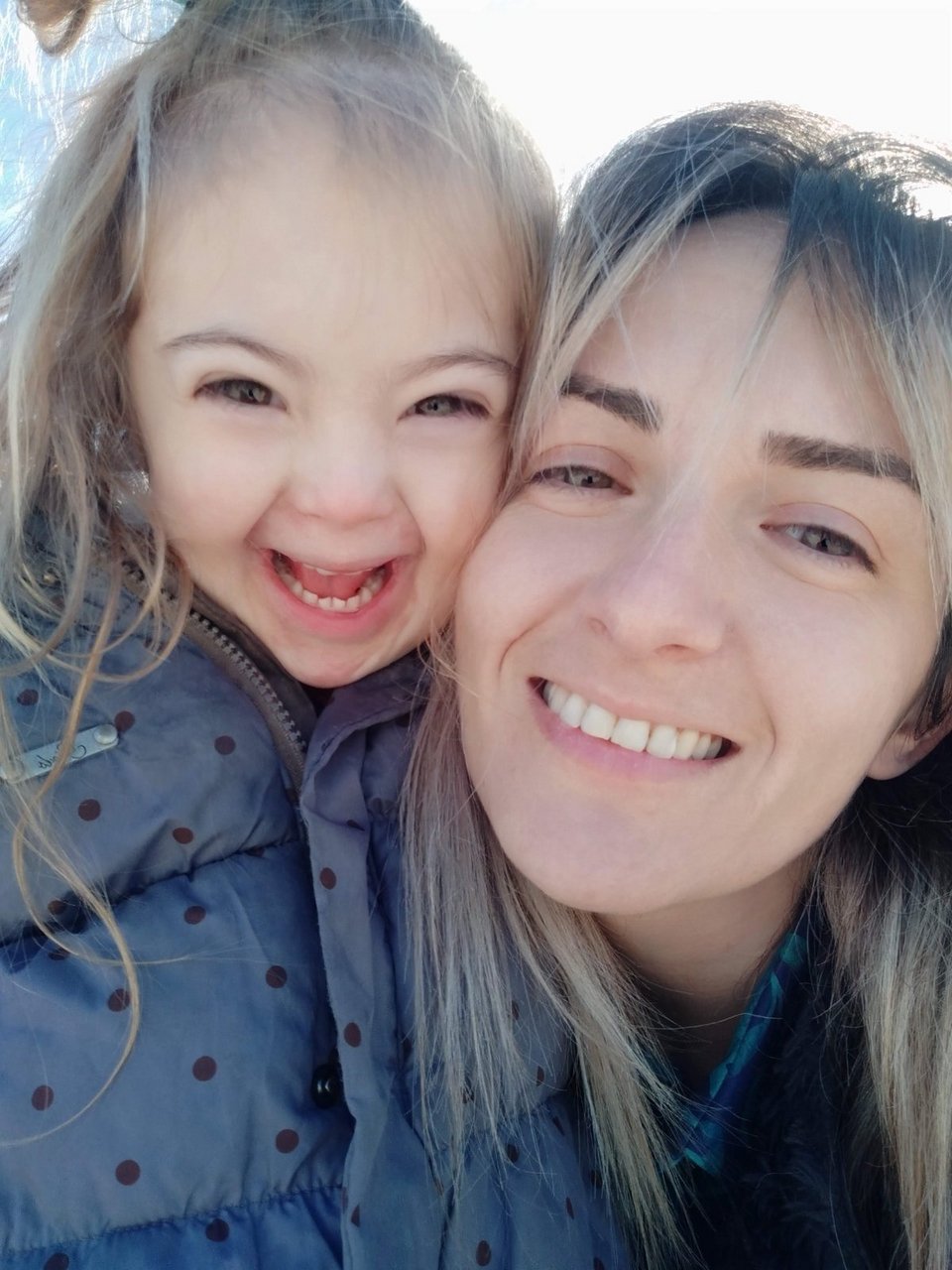 Ζέτα 8χρονη με σύνδρομο Down viral Tik Tok