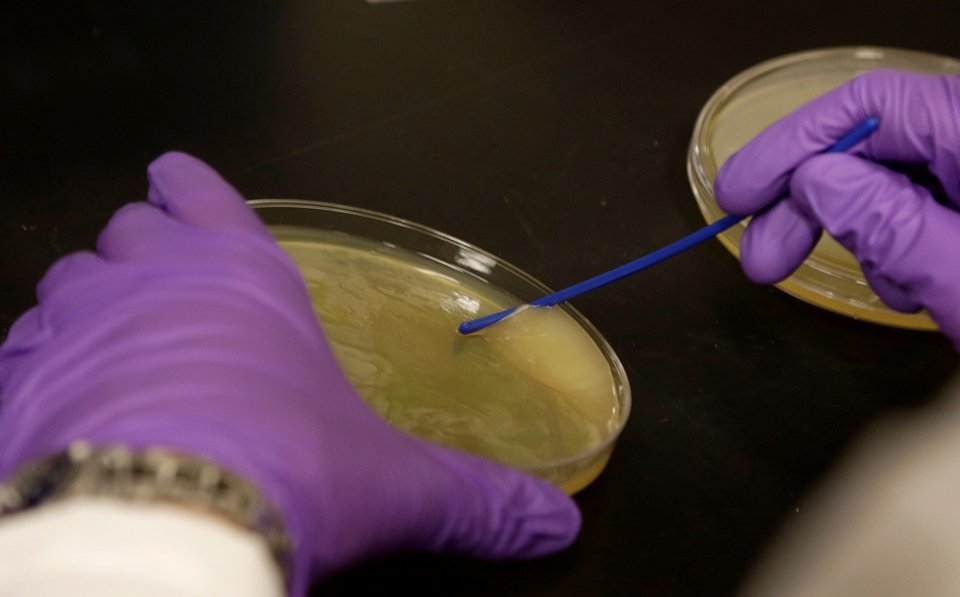 Πρωτεΐνη που επηρεάζει τη γήρανση του εγκεφάλου / Φωτογραφία: AP / Αρχείο