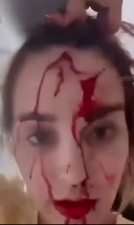 Η Μις Βενεζουέλα με αίματα στο πρόσωπο