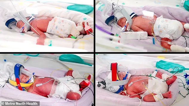 τετράδυμα