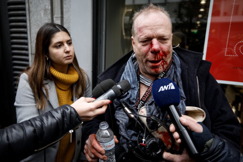 Ο δημοσιογράφος Θωμάς Ιακόμπι χτυπημένος από ακροδεξιούς Φωτογραφία: Eurokinissi/Γιώργος Κονταρίνης