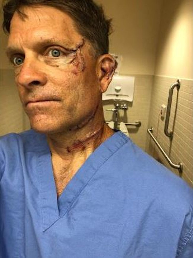 Η αρκούδα λίγο έλειψε να κόψει την καρωτίδα του 54χρονου Ντέιβ Τσερνόσκι.