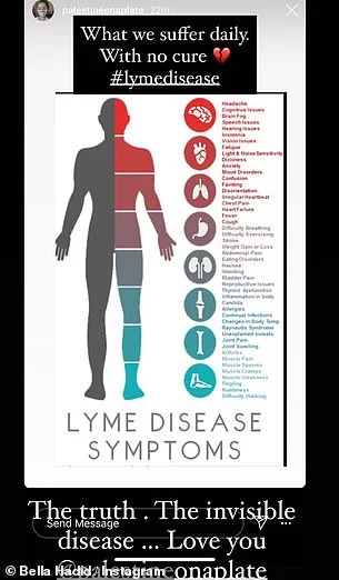 Μπέλα Χαντίντ νόσος του Lyme