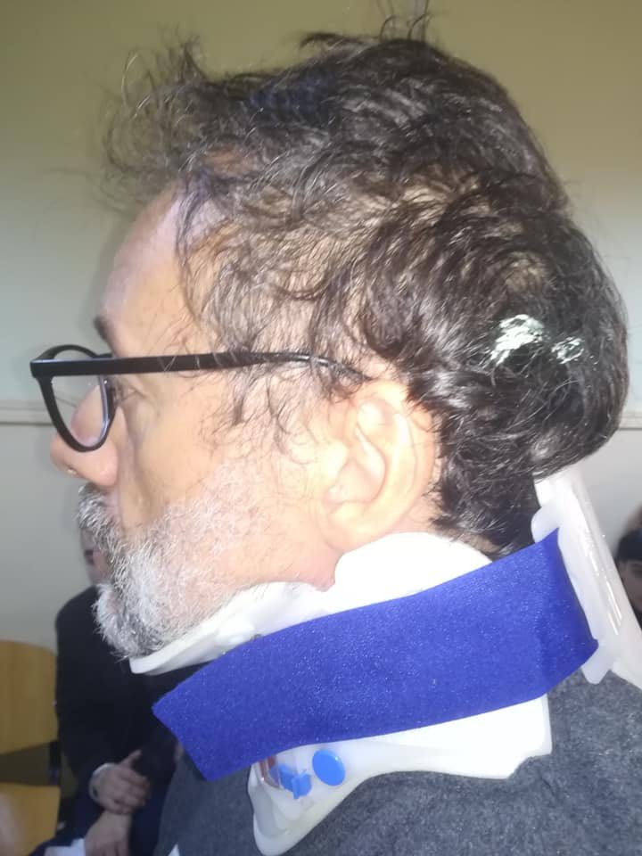 Ο σκηνοθέτης Δημήτρης Ινδαρές μετά το περιστατικό στο Κουκάκι