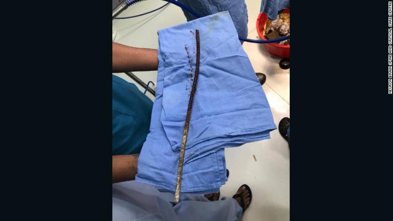 Σίδερο σε χειρουργείο νοσοκομείου