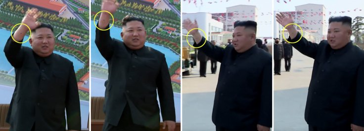 Φωτογραφίες που φέρονται να δείχνουν σημάδι στο χέρι του Κιμ Γιονγκ Ουν (KCTV)