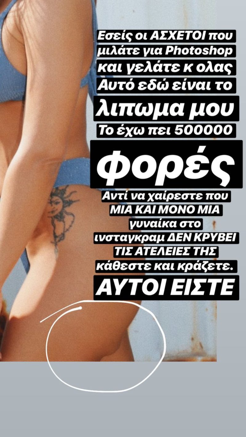 Το λίπωμα της Κόνι Μεταξα