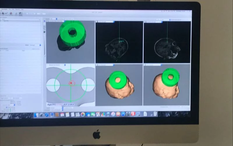 Η απεικόνιση στον υπολογιστή