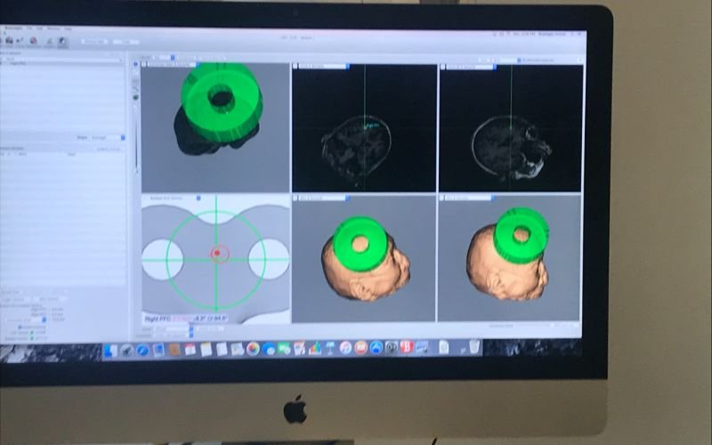 Η απεικόνιση στον υπολογιστή