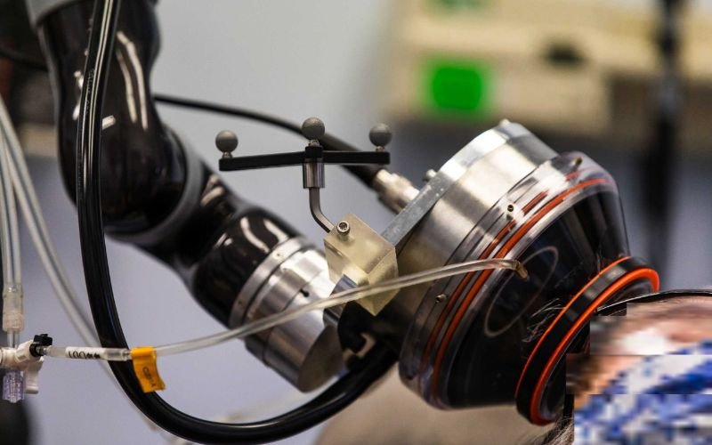 Το σύστημα των υπερήχων