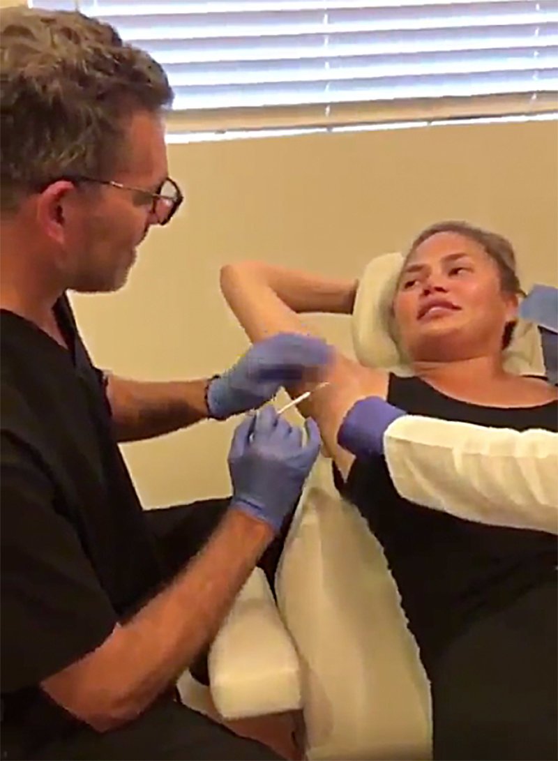 Η Κρίσι Τέιγκεν κάνει botox