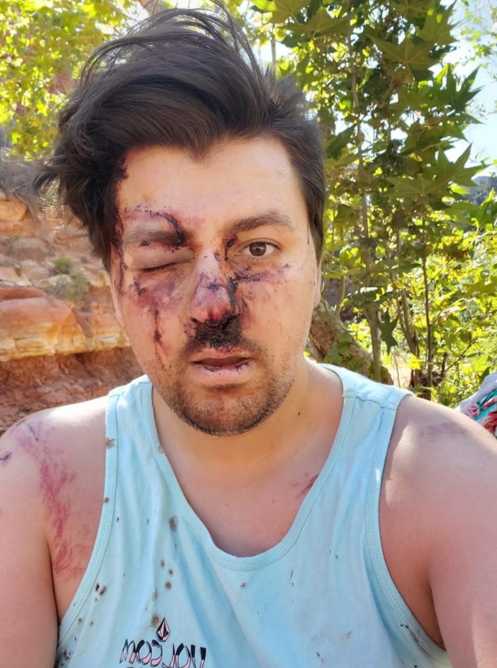 Ο 24χρονος Τζέικομπε Βελάρντε αναρρώνει από τα τραύματά του