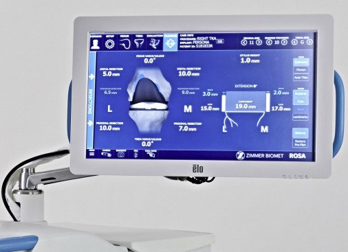 ROSA® Knee System