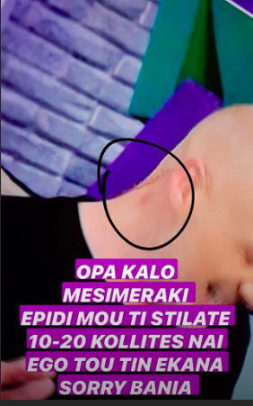 Η ανάρτηση της Σούλα Γκλάμορους για το σημάδι στο λαιμό του Νίκου Μουτσινά