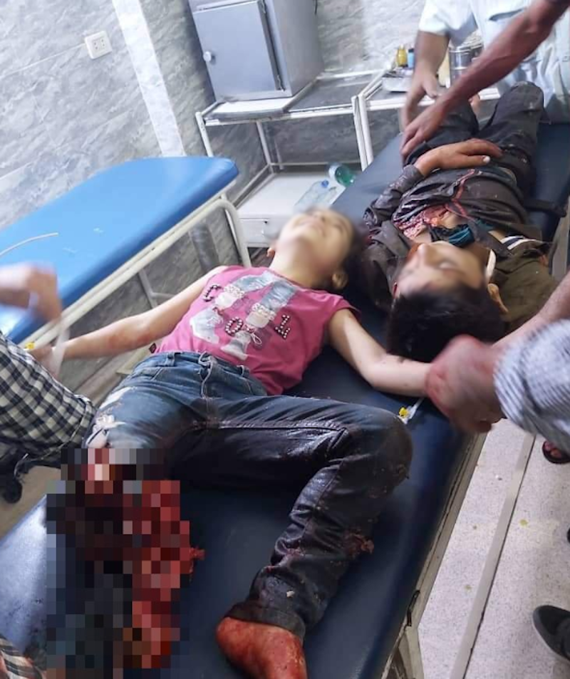 Μετά από την τουρκική εισβολή, πολλά παιδιά τραυματίστηκαν και είναι σε κρίσιμη κατάσταση / Φωτογραφία: Twitter