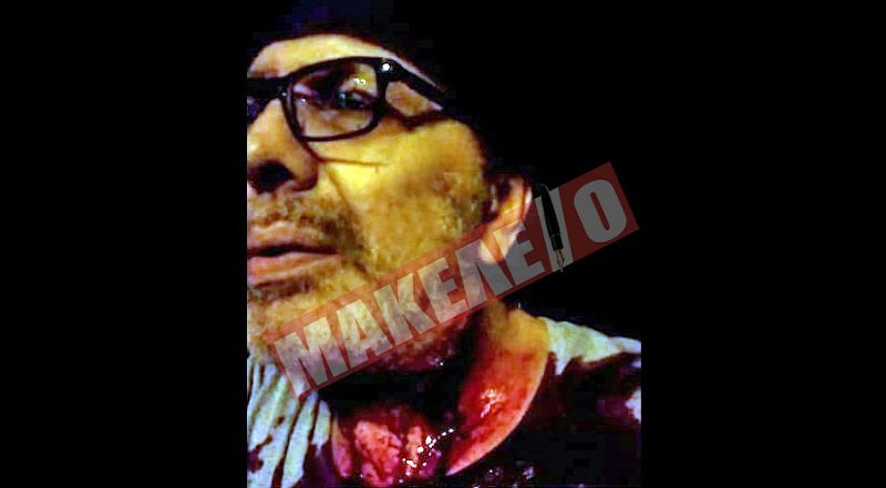 Η φωτογραφία που ανέβασε ο Στέφανος Χίος μετά την επίθεση που δέχθηκε