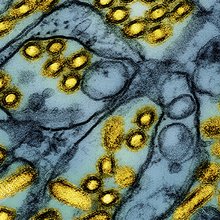 O ιός Η5Ν1 που προκαλεί την γρίπη των πτηνών