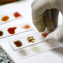 Το πιο σπάνιο αίμα στον κόσμο μοιάζει σχεδόν με μύθο – κι όμως κυκλοφορεί σε ελάχιστες φλέβες σε ολόκληρη την υφήλιο / SHUTTERSTOCK