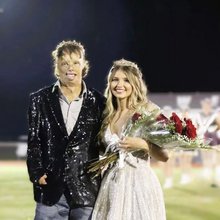 Σε ηλικία 18 μηνών υπέστη εγκαύματα σε όλο το σώμα του, αλλά χάρη στην επιμονή του δεν το έβαλε ποτέ κάτω 