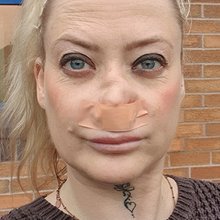 Η 41χρονη Βρετανίδα που πήγε στην Τουρκία για νέα δόντια