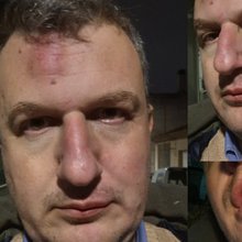 Άγριος ξυλοδαρμός του εκδότη της «ΜΑΓΝΗΣΙΑΣ» έξω από το σπίτι του στο Βόλο