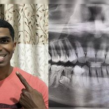 Ένας 33χρονος από τη Μαλαισία κατέκτησε μια ασυνήθιστη θέση στο βιβλίο των παγκόσμιων ρεκόρ, καθώς διαθέτει συνολικά 42 δόντια / FACEBOOK