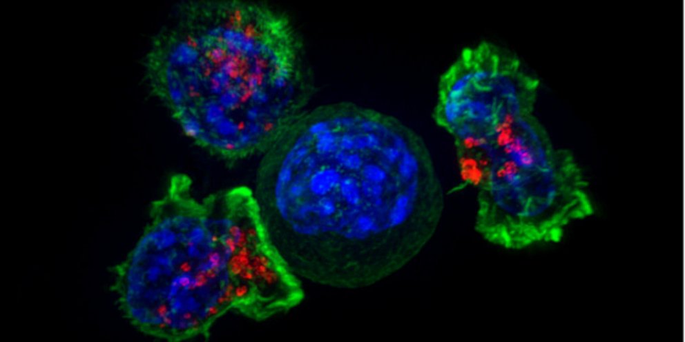 Killer-T-cells-surround-a-cancer-cell.jp