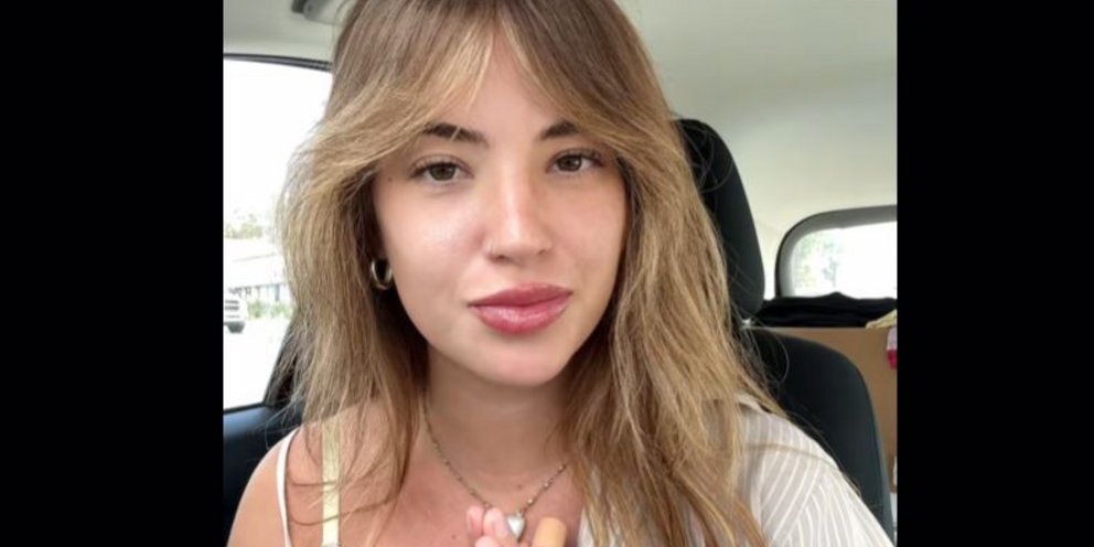 Η 26χρονη Σιέρα Κάνον ονειρευόταν πάντα να αποκτήσει φακίδες