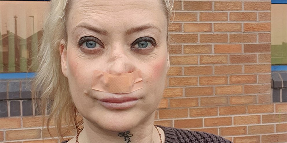 Η 41χρονη Βρετανίδα που πήγε στην Τουρκία για νέα δόντια