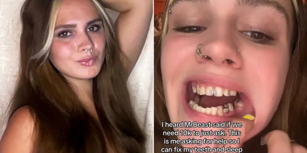 Ζήτησε βοήθεια από το TikTok για να φτιάξει τα δόντια της