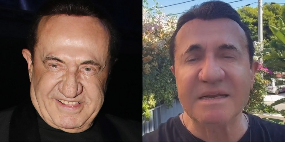 Πρησμένος ο Λευτέρης Πανταζής σε βίντεο στο instagram - Σοκ στα σόσιαλ, η εξήγηση που έδωσε [βίντεο]