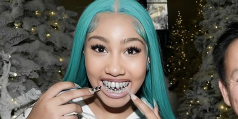 Η κόρη της Κιμ Καρντάσιαν με διαμαντένια grillz και μπλε μαλλιά στο Instagram