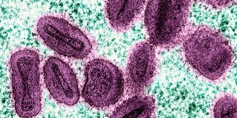 Ερευνητές ανέκτησαν DNA ευλογιάς που αποδεκάτισε τους ιθαγενείς της Αμερικής, από δύο μούμιες 500 ετών στη Χιλή