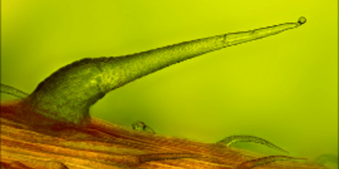 Ένας πανέμορφος μικρόκοσμος - Εντυπωσιακά στιγμιότυπα από μικροσκόπιο [εικόνες]