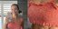 Η Έμιλυ Σκάι δείχνει το χαλαρό δέρμα στο σώμα της και στέλνει ηχηρό μήνυμα
