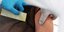 εμβόλιο κορωνοϊού σε μπράτσο από νοσηλευτή με μπλε γάντια