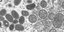 Σωματίδια του ιού της ευλογιάς σε ηλεκτρονικό μικροσκόπιο