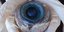 Γιγάντιο μάτι σε μέγεθος γκρέιπφρουτ ξεβράστηκε σε παραλία της Φλόριντα