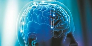 Τι συμβαίνει στον εγκέφαλο κατά τη διάρκεια του ηλεκτροσόκ;