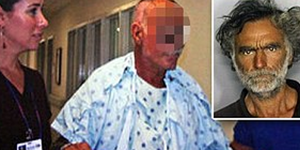 Ο κανίβαλος πράγματι του έφαγε όλο το πρόσωπο- Οι πρώτες φωτογραφίες [εικόνες]