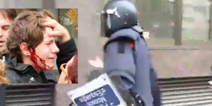 Τα ΜΑΤ στην Ισπανία χτύπησαν με γκλοπ και άνοιξαν το κεφάλι 13χρονου [βίντεο]