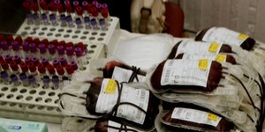 Ο ελβετικός Ερυθρός Σταυρός μειώνει τις μονάδες αίματος στην Ελλάδα λόγω... χρεώ