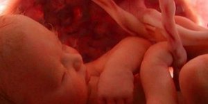 Εκπληκτική φωτογραφία: Μωρό στον αμνιακό σάκο