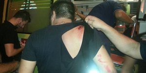 Ταυτοποιήθηκαν τρεις από τους δράστες στην επίθεση στο Πέραμα – Σεσημασμένος συν