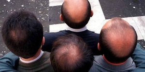 Βρέθηκε το φάρμακο για τη φαλάκρα- Αμερικανοί επιστήμονες κάνουν τα μαλλιά να ξα