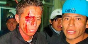 Παίκτης αστόχησε σε πέναλτι και ο πρόεδρος διέταξε να ξυλοκοπήσουν τον ίδιο